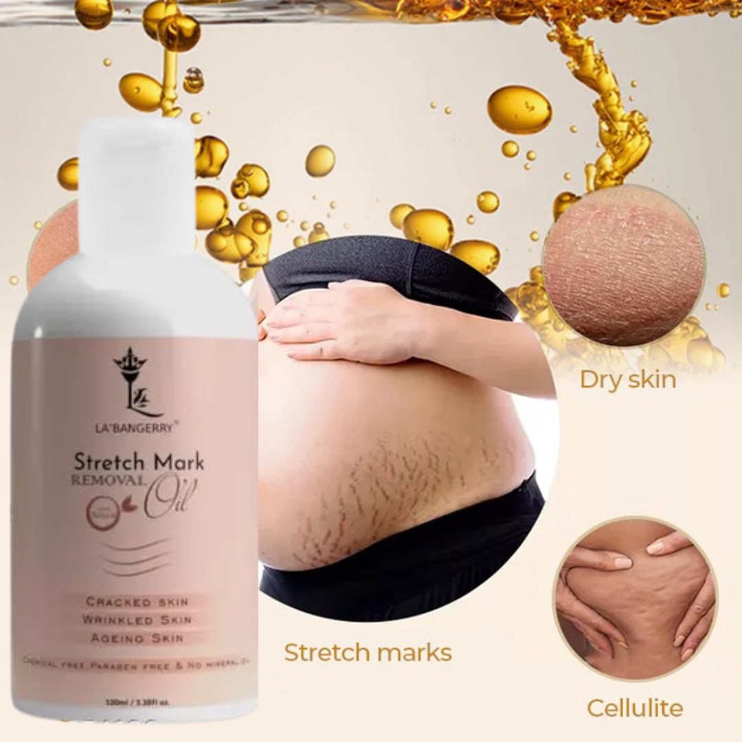 Roposo Clout Natural Stretch Marks Removal Oil (Pack of 2) - view 8