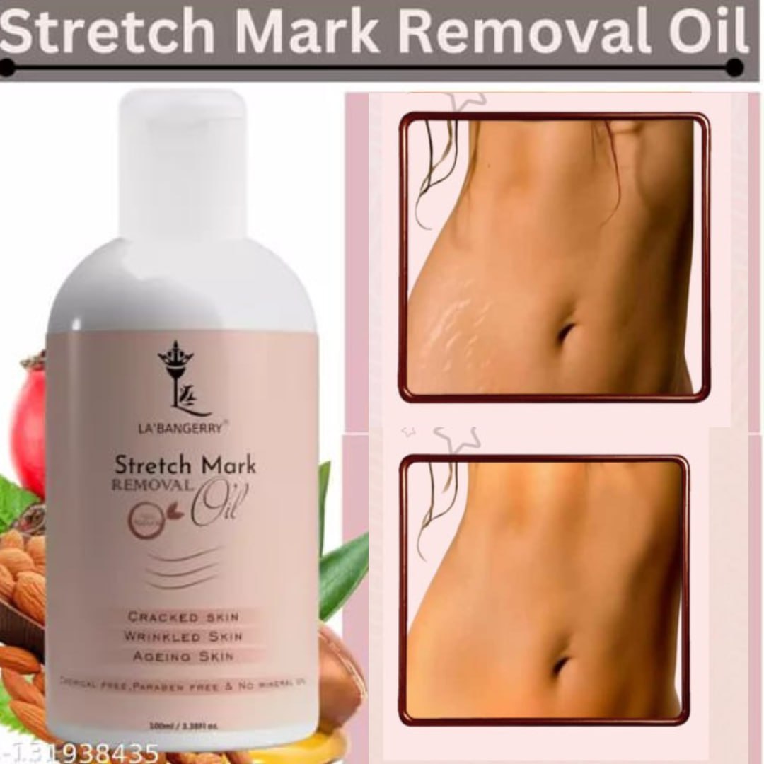 Roposo Clout Natural Stretch Marks Removal Oil (Pack of 2) - view 2