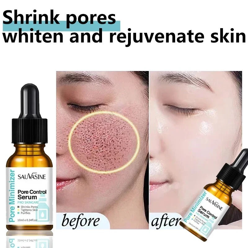 Roposo Clout Best Pore Removing Face Serum (Pack Of 2) - view 5