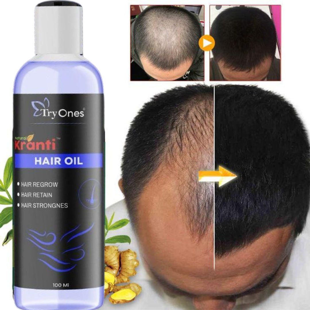 Roposo Clout Natural & Strong Hair Growth Oil 100ml - view 3