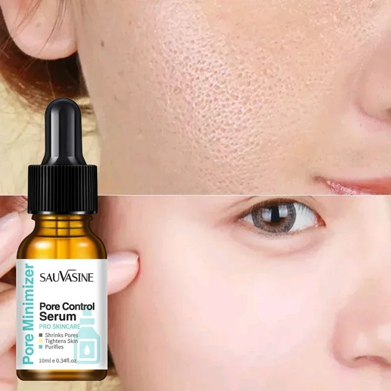 Roposo Clout Best Pore Removing Face Serum (Pack Of 2) - view 3