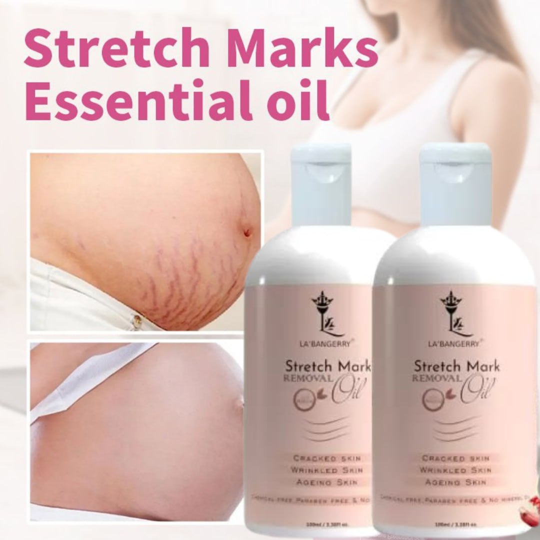 Roposo Clout Natural Stretch Marks Removal Oil (Pack of 2)