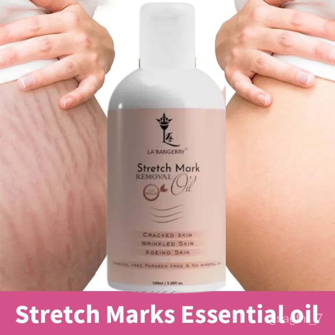 Roposo Clout Natural Stretch Marks Removal Oil (Pack of 2) - view 9