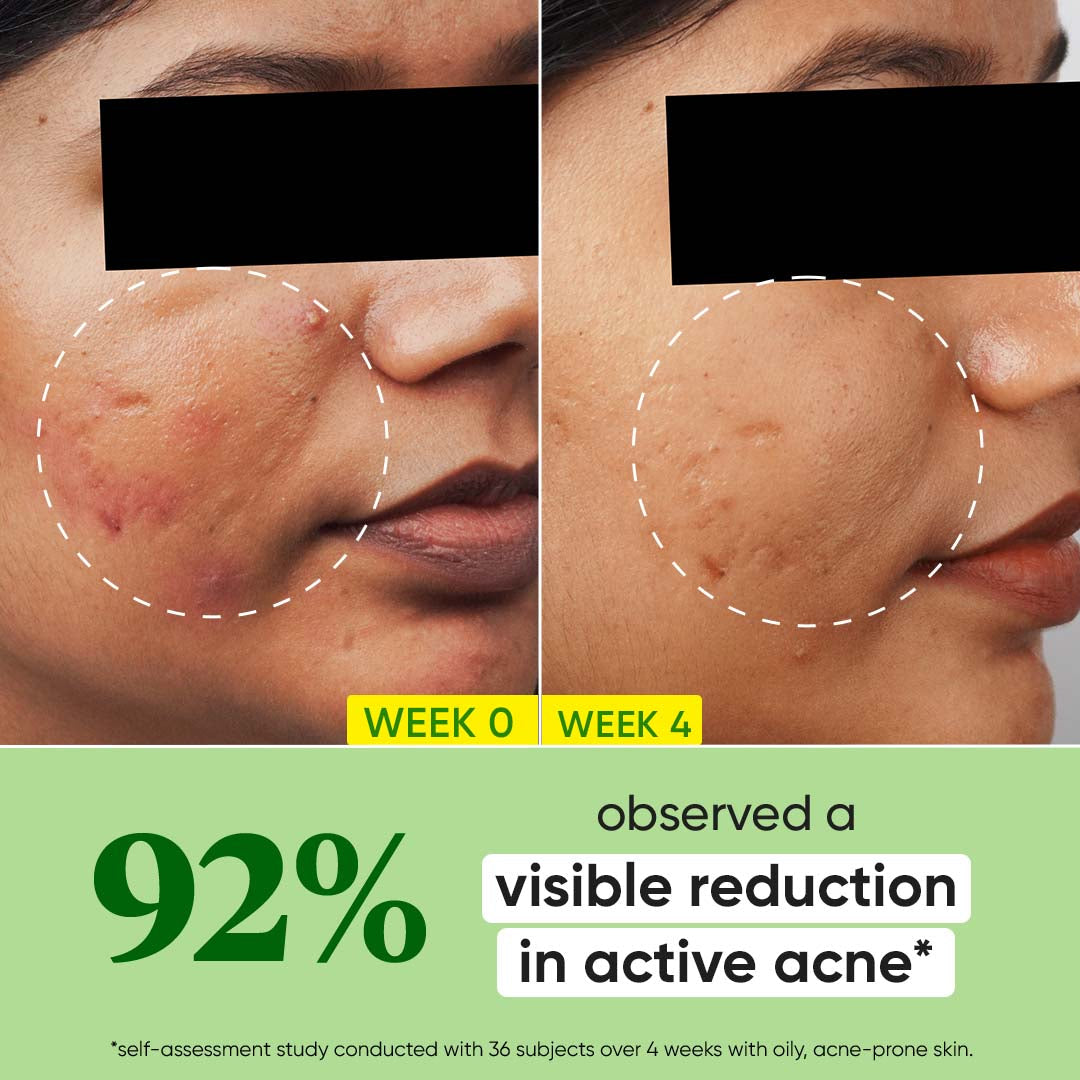 Dot & Key Cica + 2% Salicylic Serum for Acne & Oil Control - view 3