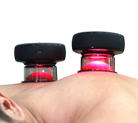Cash on Delivery Available Smart Cupping Massager PRO - view 2