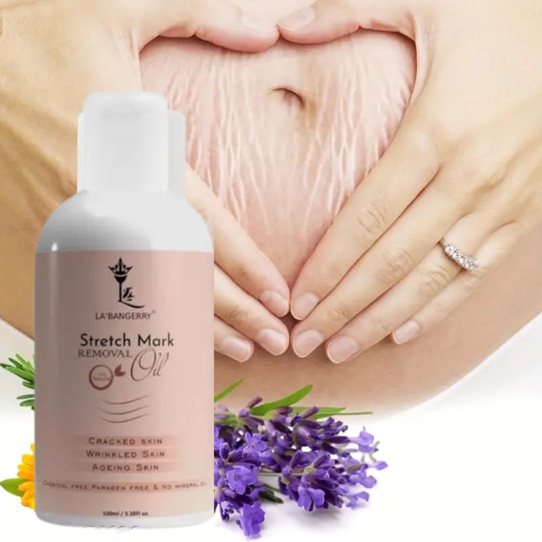 Roposo Clout Natural Stretch Marks Removal Oil (Pack of 2) - view 3