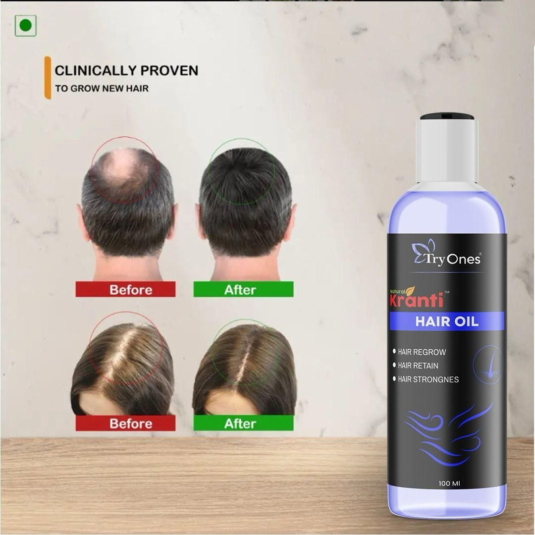Roposo Clout Natural & Strong Hair Growth Oil 100ml - view 4