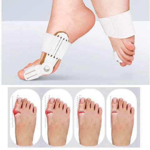 Catterton Effective Adjustable Toe Corrector - view 2